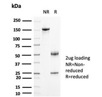 CKB Antibody / Creatine kinase B / Creatine Phosphokinase-BB