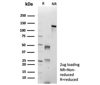 CDK4 Antibody