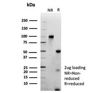 ERG Antibody / Transcriptional regulator ERG