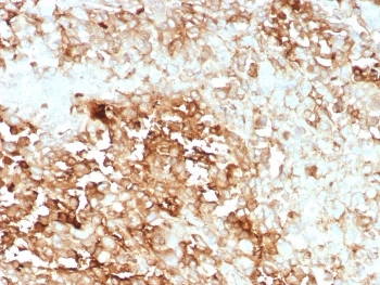 Clusterin Antibody / Apolipoprotein J / APO-J