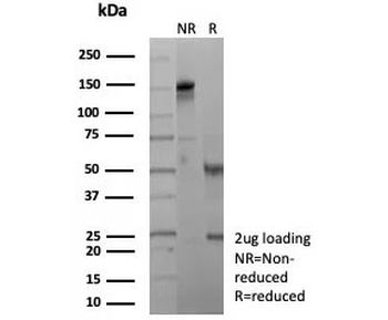 Clusterin Antibody / Apolipoprotein J / APO-J
