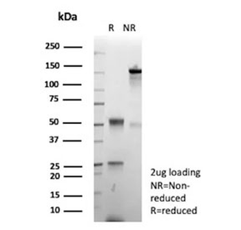 Chromogranin A Antibody