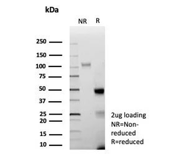 AR-V7 Antibody / Androgen Receptor