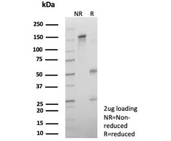 Androgen Receptor V7 Antibody