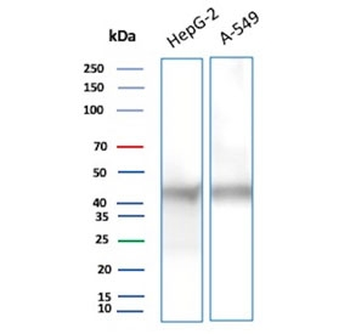 Gamma Enolase Antibody / ENO2 / NSE gamma