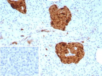 Gamma Enolase Antibody / ENO2 / NSE gamma