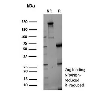 Gamma Enolase Antibody / ENO2 / NSE gamma