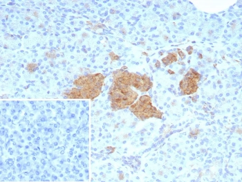 NSE gamma Antibody / ENO2 / Gamma Enolase