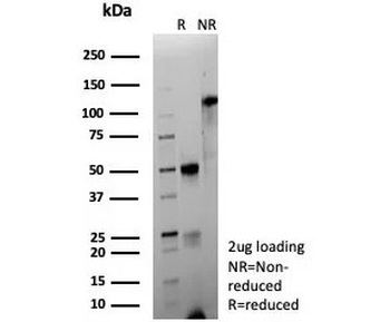 Recombinant CD63 Antibody / LAMP-3