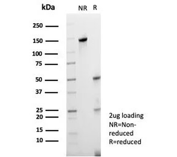 RET Antibody / c-RET