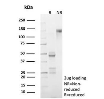 CTSD Antibody / Cathepsin D