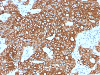Cytokeratin 8/18 Antibody