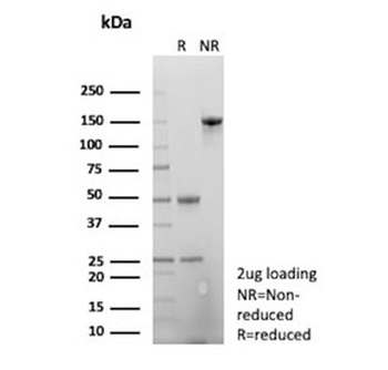 Amyloid beta Antibody / APP