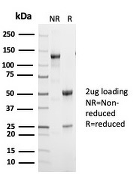 p53 Antibody / TP53