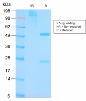 p53 Tumor Suppressor Protein Antibody