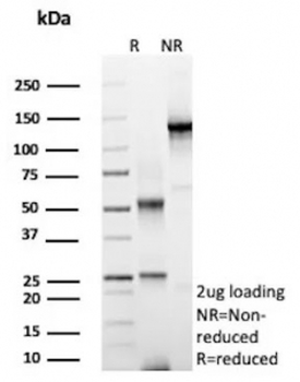 HER2 Antibody / ErbB2