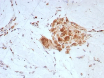 Sex Hormone Binding Globulin Antibody / SHBG