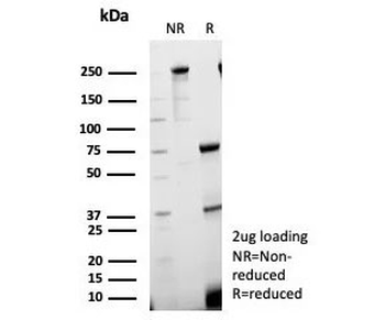 SHBG Antibody / Sex Hormone Binding Globulin