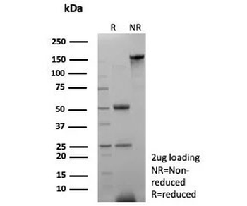 SHBG Antibody / Sex Hormone Binding Globulin