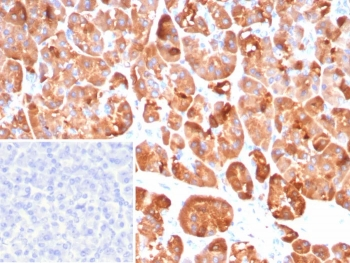 CLPS Antibody / Colipase