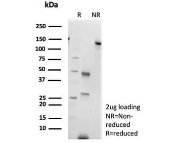 CLPS Antibody / Colipase