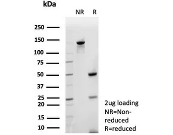CLPS Antibody / Colipase