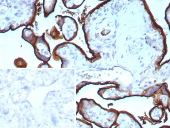 Recombinant Transferrin Receptor Antibody / TFRC / CD71 / Extracellular Domain