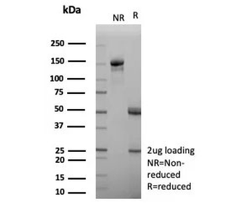 APOH Antibody / Apolipoprotein H