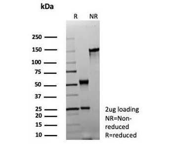 MBP Antibody / Myelin Basic Protein