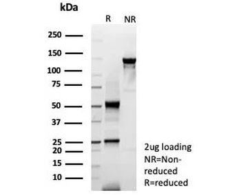 Cytokeratin 6 Antibody / Pan
