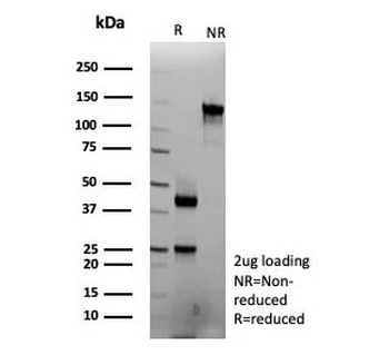 Interferon gamma Antibody