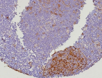 Cystatin A Antibody / CSTA