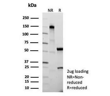 Cystatin A Antibody / CSTA
