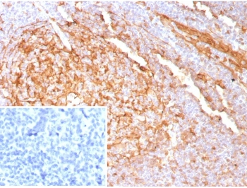 Cystatin A Antibody / CSTA