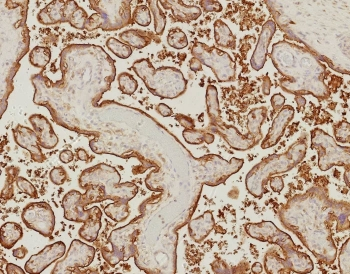 EGF Receptor / EGFR Antibody