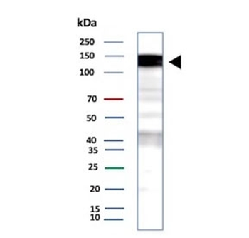 EGF Receptor / EGFR Antibody