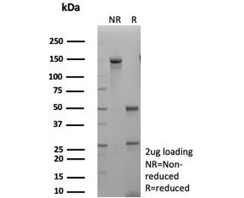 EGF Receptor / EGFR Antibody
