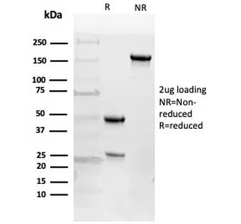 EGF Receptor / EGFR Antibody