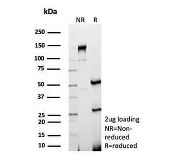 GDF9 Antibody / Growth Differentiation Factor 9