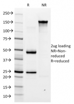 H. pylori Antibody / Helicobacter pylori