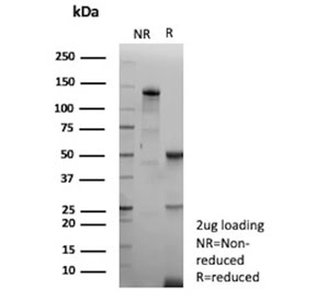 EBV Antibody / Epstein-Barr Virus