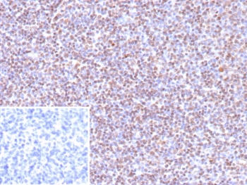 EBV Antibody / Epstein-Barr Virus