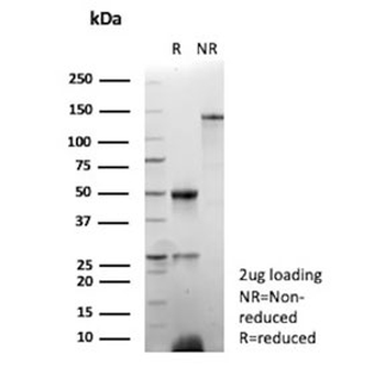 EBV Antibody / Epstein-Barr Virus