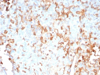 IL-2 Antibody