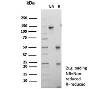 IGFBP3 Antibody