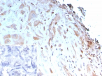 IGFBP3 Antibody