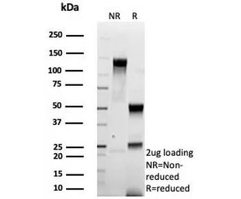 HER2 Antibody / ErbB2