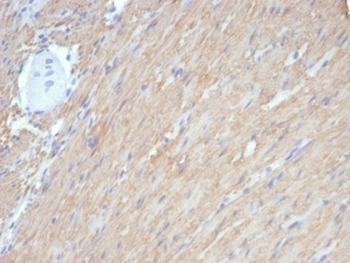 Recombinant CALD1 Antibody/ Caldesmon / CAD (HMW)