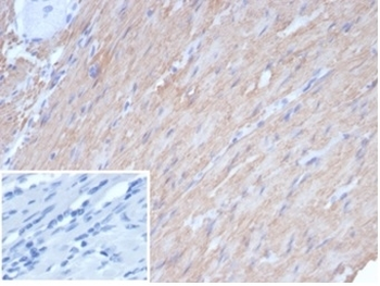 Recombinant CALD1 Antibody/ Caldesmon / CAD (HMW)