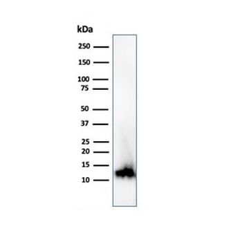 FABP1 Antibody